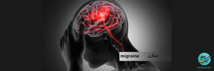 درمان میگرن با طب هومیوپاتی | رویکردی طبیعی برای کاهش حملات سردرد مزمن